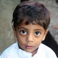 Mewaspadai-Leukemia-Pada-Anak