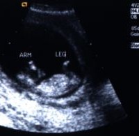 Tahap-Perkembangan-Janin-Usia-5-Bulan