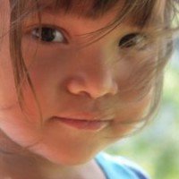 mengatasi-alergi-makanan-pada-anak