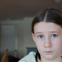 Leukemia-Limfoblastik-Akut