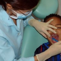 penyebab-karang-gigi-anak