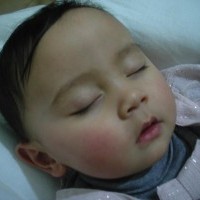 Imunisasi DPT pada Anak