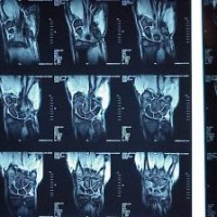 bahaya-sinar-rontgen-pada-kehamilan-trimester-2