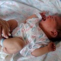 imunisasi-bcg-pada-bayi