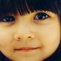 anafilaksis-ketika-alergi-mengancam-jiwa