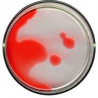 manfaat-tes-kadar-hemoglobin-pada-trimester-2