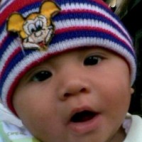 Macam-macam Kelainan Mata pada Bayi