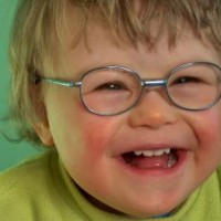 Penanganan Pada Bayi Hemangioma