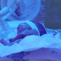 resiko-saat-melahirkan