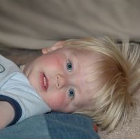 Mengatasi cacar air pada anak