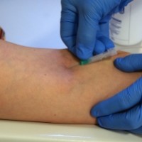 ibu-berdarah-rhesus-negatif