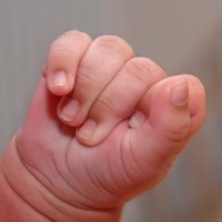 Cara Menangani Keseleo Pada Anak