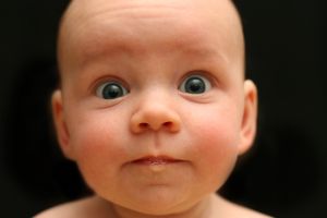 Bagaimana Cara Mengobati Cradle Crap pada Bayi