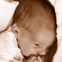 Tips mengatasi Cradle Crap pada Bayi